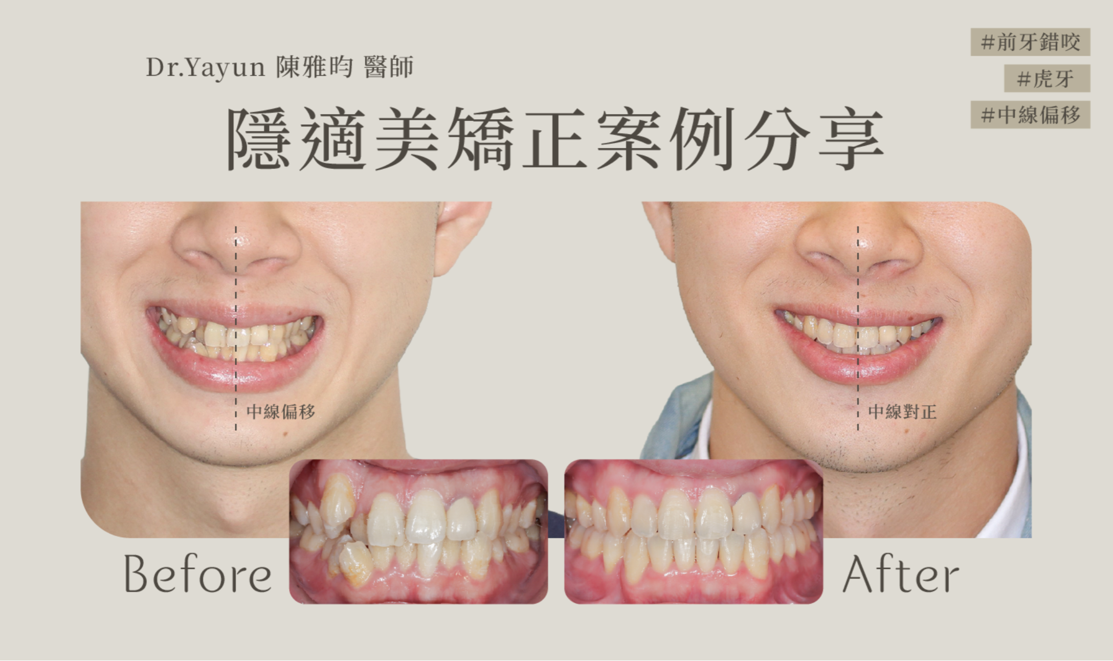 截圖 2025 07 21 下午4.43.28