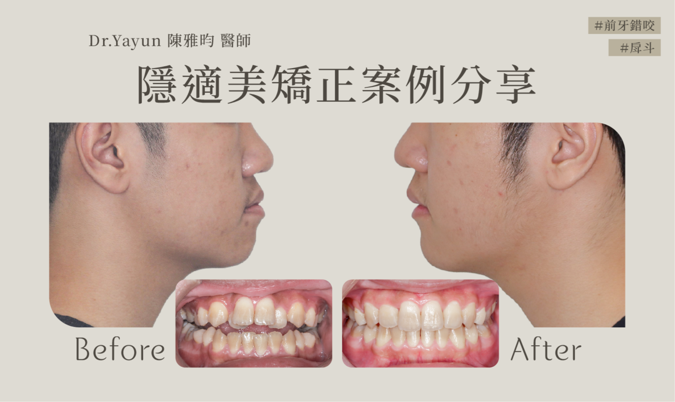 截圖 2025 07 21 下午4.45.15